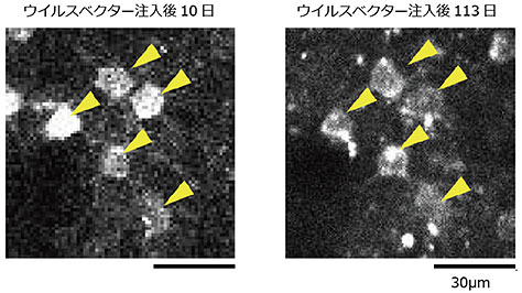 図2 マーモセット大脳皮質神経細胞の長期的観察