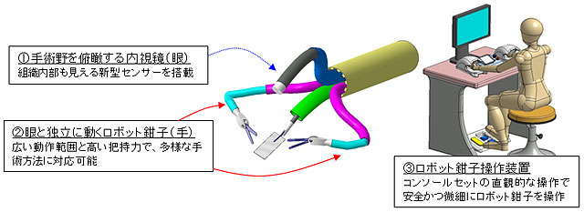 軟性内視鏡手術システム説明図