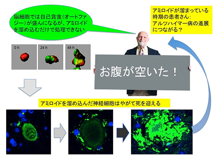 説明図