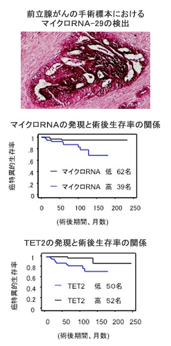 図3. マイクロRNA-29が過剰な前立腺がんの患者では生命予後が不良になる。