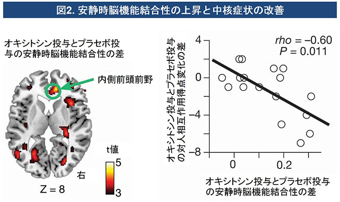 図2．安静時脳機能結合性の上昇と中核症状の改善