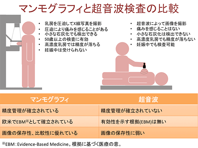 マンモグラフィと超音波検査の比較