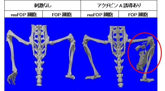 図5. FOP-iPS細胞由来間葉系間質細胞を用いた異所性骨モデル