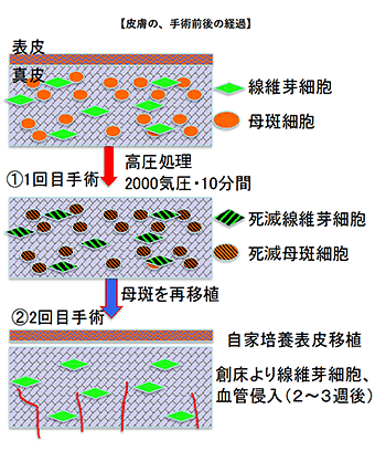 皮膚の、手術前後の経過