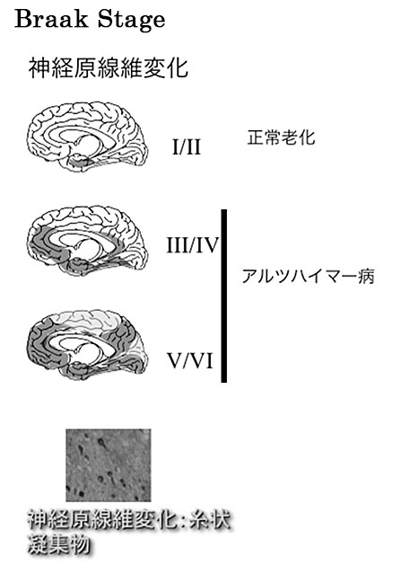 説明図・2枚目