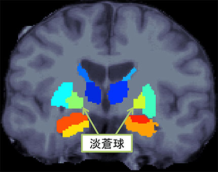 説明図・1枚目