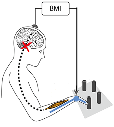 脳波ーBMIリハビリテーションシステム