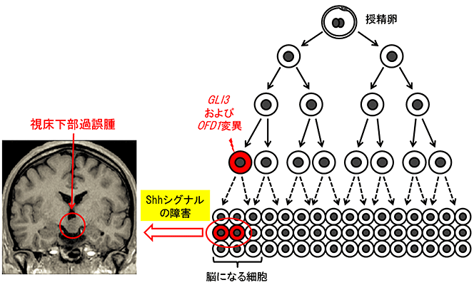 説明図