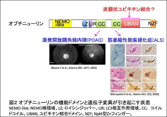 図2　オプチニューリンの機能ドメインと遺伝子変異が引き起こす疾患