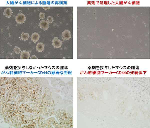 大腸がん幹細胞の機能を抑制