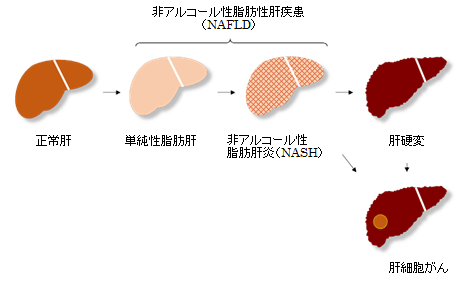 説明図・4枚目