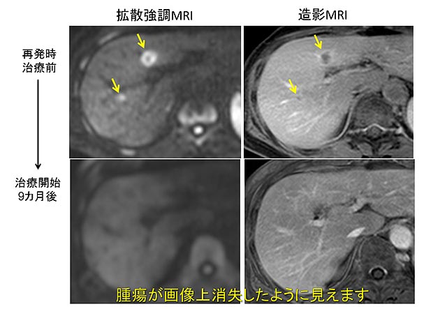 説明図・1枚目（説明は本文中に記載）