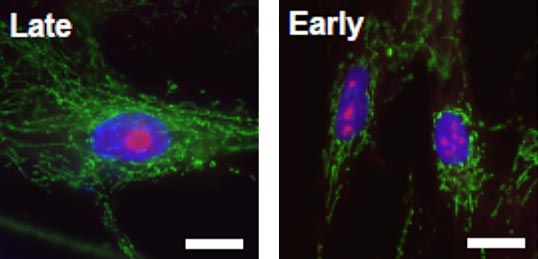 培養早期の増殖中（Early）および培養後期の老化状態（Late）のヒト線維芽細胞