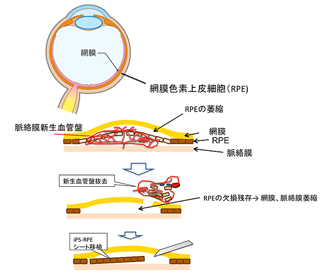 説明図・1枚目（説明は本文中に記載）