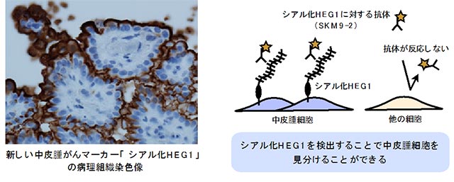 説明図・1枚目（説明は本文中に記載）