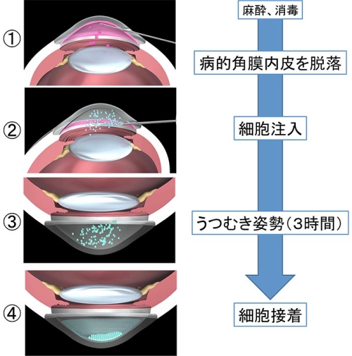 説明図・3枚目（説明は本文中に記載）