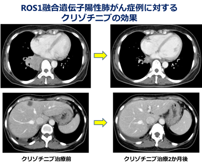 説明図・2枚目（説明は本文中に記載）