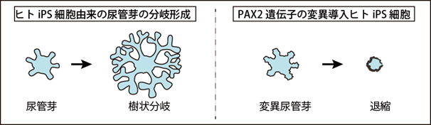 図5 ヒトiPS細胞から作成した尿管芽の樹状分岐形成とPAX2遺伝子の変異導入iPS細胞に見られた形態形成異常