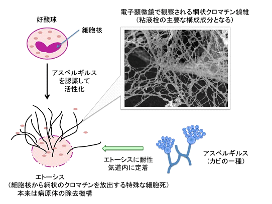  アスペルギルスの画像