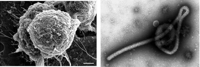 図1：エボラウイルスの電子顕微鏡写真