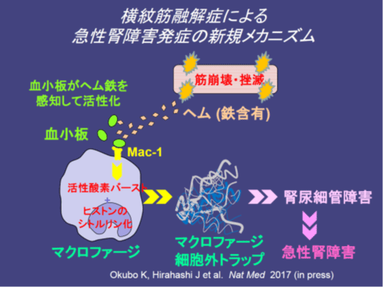 横紋筋融解症による急性腎障害発症の新たなメカニズムを解明 発症予防の薬剤開発へつながる成果 国立研究開発法人日本医療研究開発機構