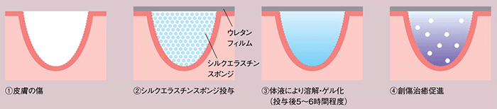 図3．シルクエラスチンスポンジを用いた傷の治療