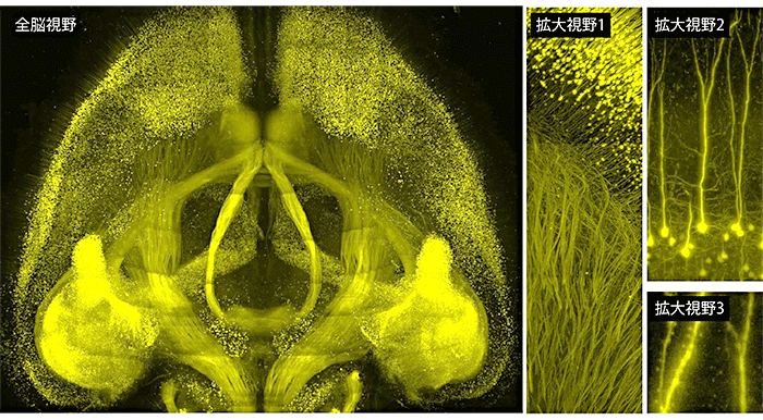 図2　マウス全脳の１細胞解像度での観察