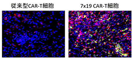 図2．7x19 CAR-T細胞治療における腫瘍内部への免疫細胞の浸潤