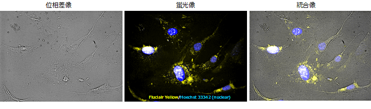 図2．FluclairTM Yellowを導入した脂肪組織由来幹細胞画像