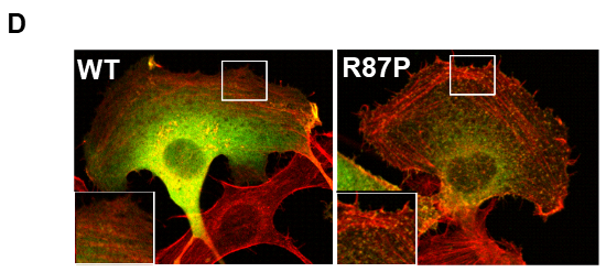 図D:正常(WT)およびCYFIP2変異体(R87P)を一過性発現させた細胞の免役染色像