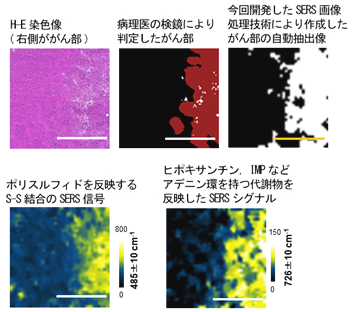 図3 マウス神経膠芽腫(グリオブラストーマ)モデルに