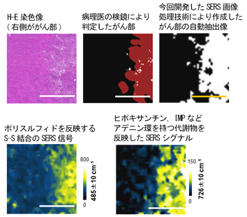 図3　マウス神経膠芽腫（グリオブラストーマ）モデルに