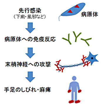 図1. ギラン・バレー症候群がおきるメカニズム