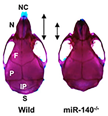 図3　miR-140欠損マウス（miR-140-/-）の頭蓋骨の骨格標本（参考文献2より）