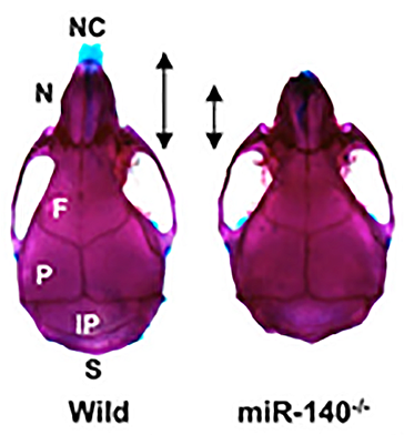 å³3ãmiR-140æ¬ æãã¦ã¹ï¼miR-140-/-ï¼ã®é ­èéª¨ã®éª¨æ ¼æ¨æ¬ï¼åèæç®2ããï¼