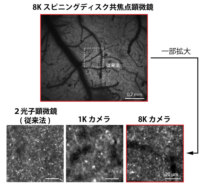 図3. 8Kスピニングディスク共焦点顕微鏡による広範囲に投射する軸索終末のイメージング