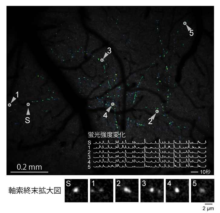 図4. 1mm以上離れた軸索終末の同期的な活動を捉えた例