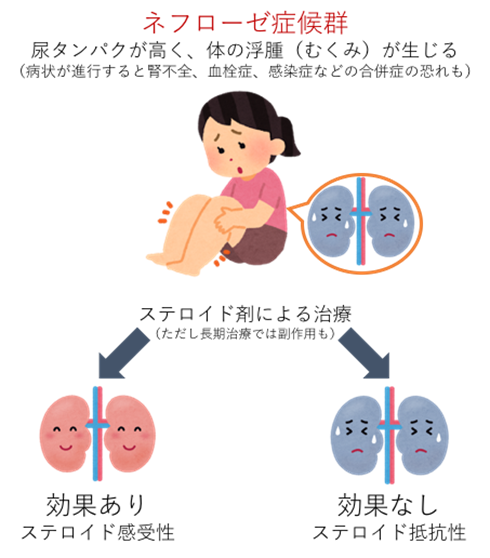 図１．ネフローゼ症候群のステロイド剤の効果による分類