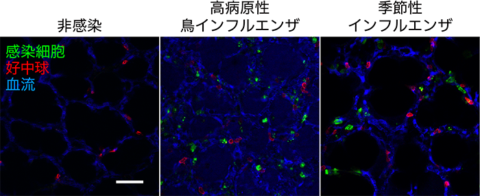 図2 インフルエンザウイルスに感染した肺の生体イメージング