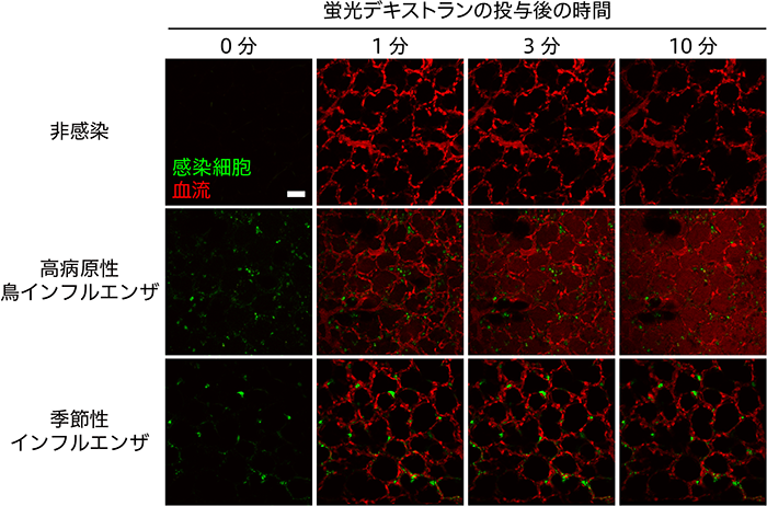 図3 インフルエンザウイルスに感染した肺における血管透過性の評価
