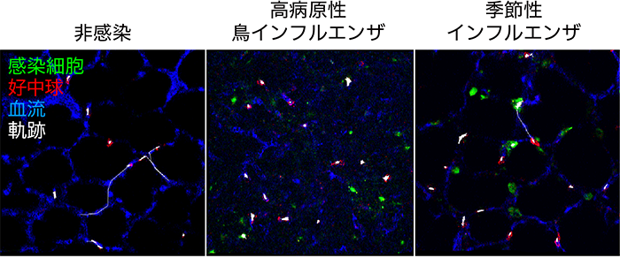 図4 インフルエンザウイルスに感染した肺における好中球の動き