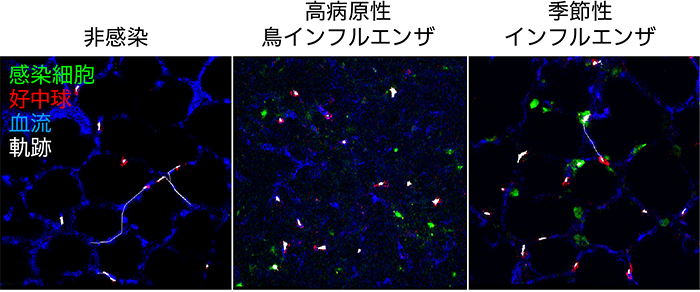 å³4ãã¤ã³ãã«ã¨ã³ã¶ã¦ã¤ã«ã¹ã«ææããèºã«ãããå¥½ä¸­çã®åã