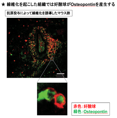 図2　気道周囲に線維化を誘導したマウス肺の免疫組染色解析