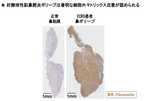 å³4ãå¥½é¸çæ§å¯é¼»èçæ£èç±æ¥ã®ããªã¼ãã®åç«çµç¹æè²è§£æ