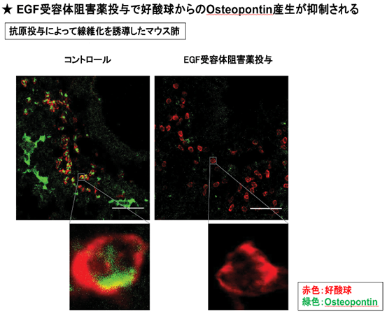 図3　気道周囲に線維化を誘導したマウスへEGF受容体阻害薬を投与した際の肺免疫組織染色解析