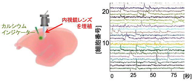 図1. 小型蛍光顕微鏡による運動野のカルシウムイメージング