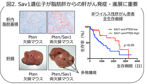 Sav1遺伝子が脂肪肝からの肝がん発症・進展に重要