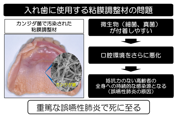 画像_カンジダ菌で汚染された粘膜調整剤