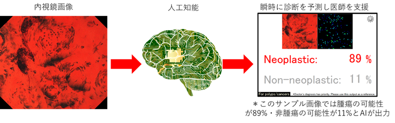 AIを搭載した内視鏡診断支援プログラム概要図