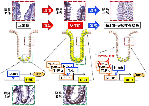 図2_炎症性腸疾患患者におけるUBDの発現変化